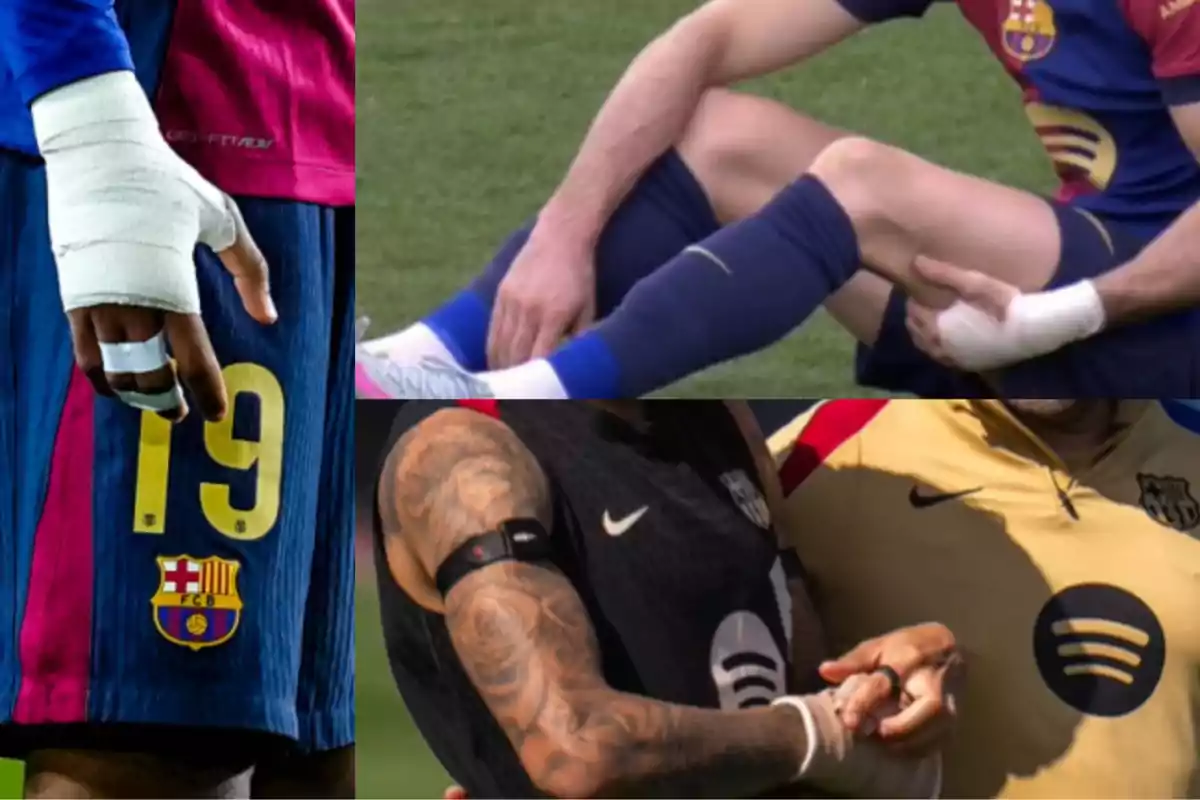 FC Barcelona players with bandages on their hands and legs during a match. FC Barcelona players with bandages on their hands and legs during a match.